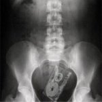 As Radiografias Mais Bizarras do Mundo