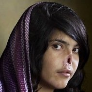 Foto de Afegã Mutilada pelo Marido Vence Concurso