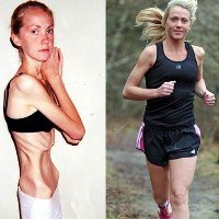 Jovem Supera Anorexia e Vira Uma Linda Maratonista
