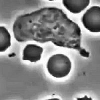Como os Glóbulos Brancos Perseguem Bactérias (com Video)