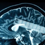 Cientistas Criam 1Âº Chip de MemÃ³ria para o CÃ©rebro
