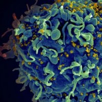 Vacina Brasileira Contra a AIDS Começa a Ser Testada