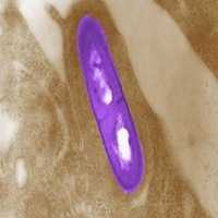 Infecção Por Listeria: Sintomas e Tratamento